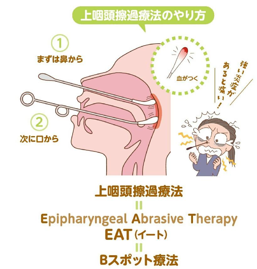 慢性上咽頭炎を治せば不調が消える(扶桑社ムック)堀田修先生監修 慢性上咽頭炎を治せば不調が消える(扶桑社ムック)堀田修先生監修